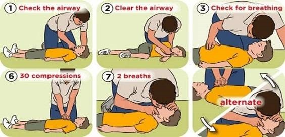 Hướng dẫn sơ cứu người bị đuối nước đúng cách theo chuẩn y tế